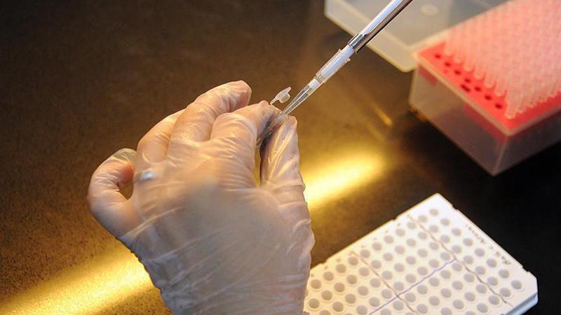Kanserin yayılması yüzde 75 engellendi Kanserin yayılması yüzde 75 engellendi